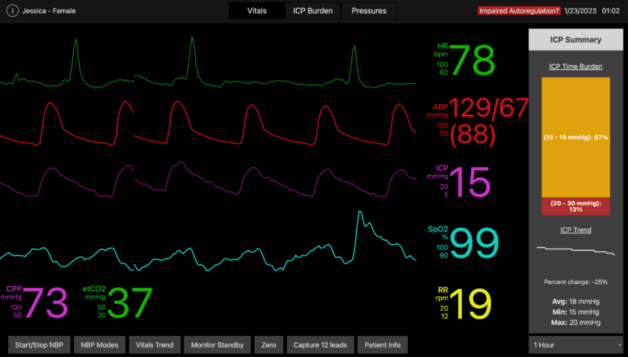 Critical Care Monitoring System